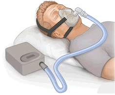 sleep-apnea-machine-and-mask