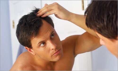 treatment-for-male-pattern-baldness