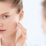 How to Treat Acne Prone Skin